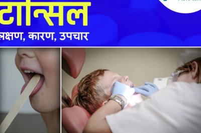 Tonsil Stones: Causes, Symptoms, And Treatment In Hindi