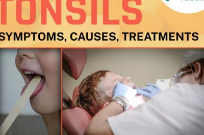 Tonsil Stones: Causes, Symptoms, and Treatment Options