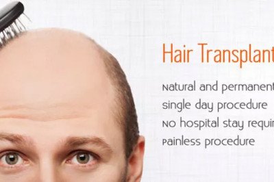 Best Hair Transplant Center in Malleshwaram-Hair Transplant