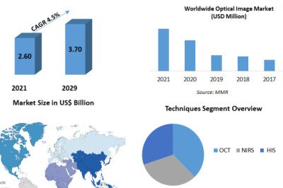 Optical Imaging Market Trends , Opportunities  Assessment and  Covid-19 Impact Analysis