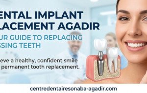 Dental Implant Placement Agadir: Your Guide to Replacing Missing Teeth