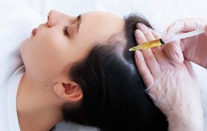 PRP Hair Treatment in 2026: Should You Combine PRP With Other Hair Loss Treatments for Better Long-Term Results?