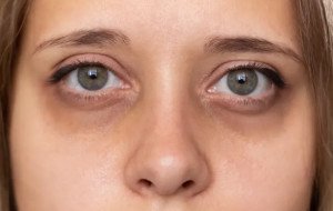 Eye Health – Eye Exams, Vision Correction, Eye Diseases