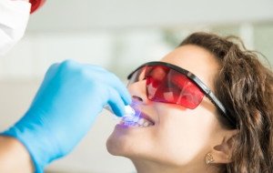 Teeth Whitening: Understanding Your Options for a Brighter Smile