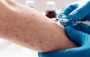 Allergist Savannah GA: What to Expect During Your First Allergy Test