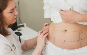 What Should You Look for in a Laser Liposuction Clinic?